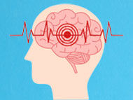 Stroke Risk for Heart Valve & AFib Patients