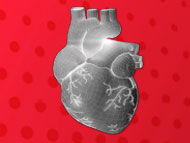 Doctor Q&A: Stopping The Heart for Cardiac Surgery