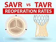 SAVR Versus TAVR Re-Operations: What Should Patients Know?