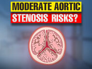 Moderate Aortic Stenosis Risks: What Should Patients Know?