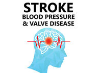 Surgeon Q&A: Stroke Risk, Blood Pressure and Heart Valve Disease