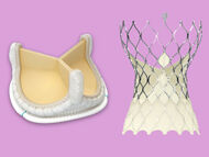 Surgeon Q&A: SAVR and TAVR Insights in 2024