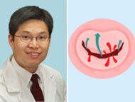 Doctor Q&A: Lifelong Management of Heart Valve Disease