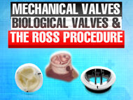 Evaluating Mechanical Valves, Biological Valves and the Ross Procedure