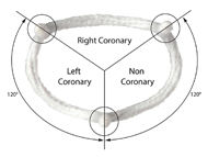 Surgeon Q&A: Aortic Valve Repair Innovations with Dr. Vinay Badhwar