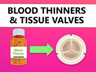 Blood Thinners & Tissue Valves: What Should Patients Know?