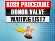 Ross Procedure Donor Valve: Is There A Waiting List for Patients?