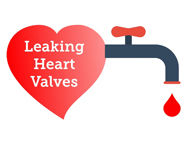 Cardiologist Q&A: Do Leaking Heart Valves Require Surgery?