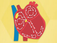 Patient Alert! New AFib Treatment Guidelines to Prevent Stroke!