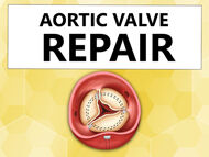 Aortic Valve Repair: Where Are We Today?