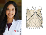 TAVR for Aortic Regurgitation: Ask Dr. Gupta