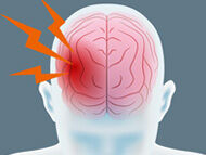 Stroke Risk & TAVR: New Insights for Patients