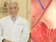 Technology Update: SCOUT Study for Tricuspid Regurgitation