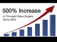 Surgeon Q&A: The Rise of Tricuspid Heart Valve Surgery with Dr. McCarthy