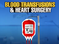 Blood Transfusions & Heart Surgery: What Should Patients Know?