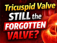  Is the Tricuspid Valve Still the 