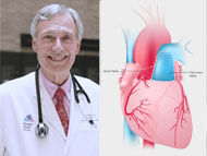 Webinar: Ross Procedure Advantages with Drs. Stelzer & El-Hamamsy