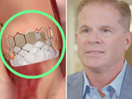 SAVR or TAVR:  Jim Whitney & Dr. Chris Malaisrie Explain Their Surgical Choice
