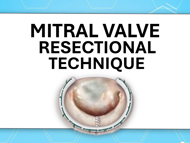 Surgeon Q&A: Mitral Valve Resection Techniques: What Should Patients Know?