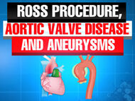 Ross Procedure, Aortic Aneurysms and Aortic Valve Disease: Is It Possible? Is It Safe?