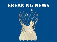 Breaking News: SMART Clinical Trial Results