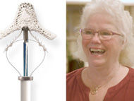 MitraClip & The COAPT Clinical Trial:  Michele's Success Story