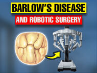 Surgeon Q&A: Can Minimally-Invasive Robotic Surgery Treat Barlow's Mitral Valve Disease?