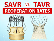 SAVR Versus TAVR Re-Operations: What Should Patients Know?