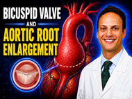 Surgeon Q&amp;A: Bicuspid Aortic Valve and Aortic Root Enlargement