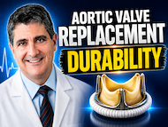 Ask Dr. Eric Roselli: Will Aortic Valve Replacements Last Longer?