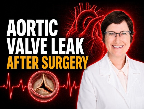 Understanding Aortic Valve Regurgitation After Heart Surgery