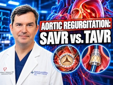 Surgeon Q&amp;A: SAVR vs. TAVR for Aortic Regurgitation