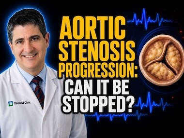 Can Aortic Stenosis Progression Be Stopped? Dr. Eric Roselli Explains New Research